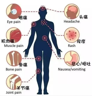 爱国卫生｜别松懈！警惕登革热与基孔肯雅热输入风险→